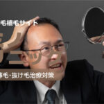 カミノクリニックの良い口コミから悪い評判を徹底レビュー!自毛植毛の料金から他社比較まで解説!