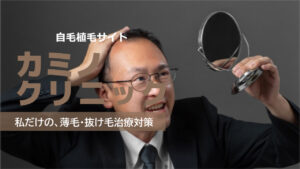 カミノクリニックの良い口コミから悪い評判を徹底レビュー！自毛植毛の料金から他社比較まで解説！
