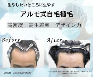 アルモ形成クリニック