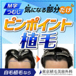 東京植毛クリニック